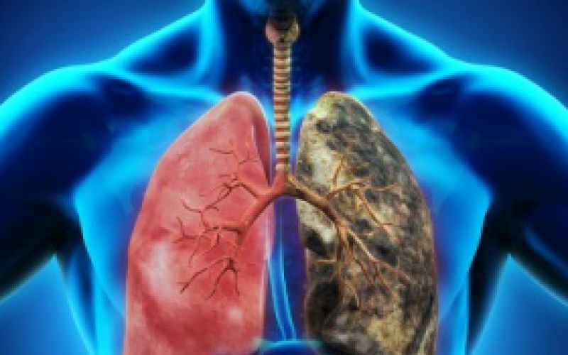 ĐIỀU TRỊ BỆNH PHỔI TẮC NGHẼN MẠN TÍNH