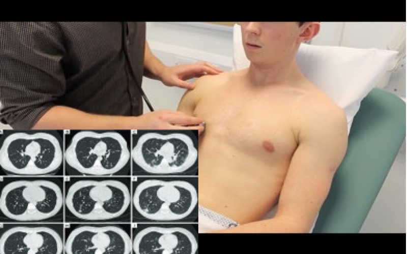 KHÁM CHỮA BỆNH HÔ HẤP CHUYÊN KHOA SÂU