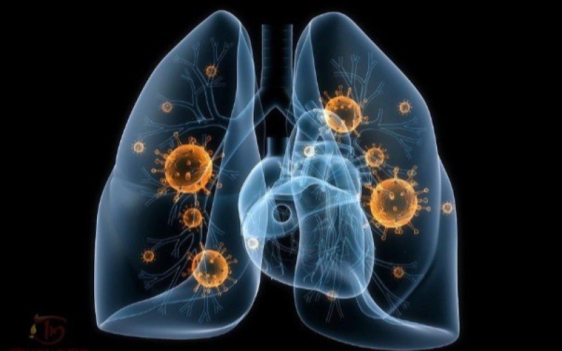 ĐIỀU TRỊ BỆNH LAO