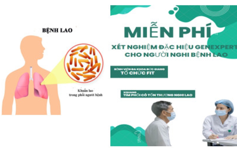 XÉT NGHIỆM ĐÀM TÌM VI KHUẨN LAO BẰNG KỸ THUẬT SINH HỌC PHÂN TỬ